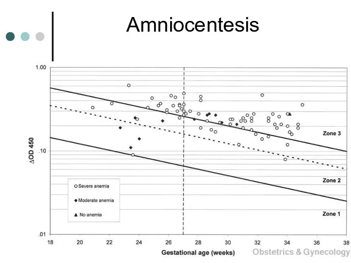 Amniocentesis