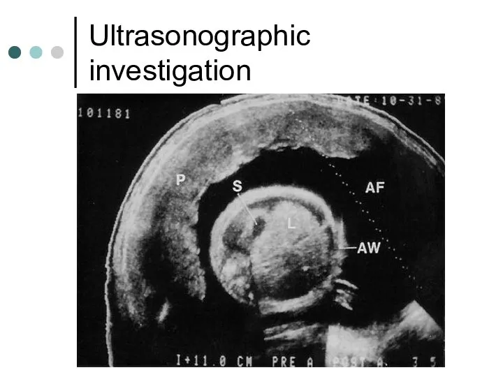 Ultrasonographic investigation