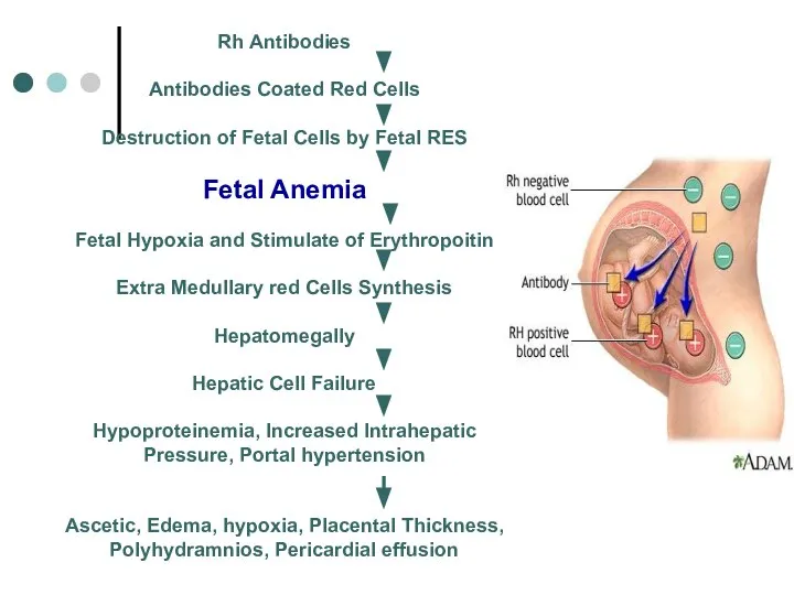 Rh Antibodies Antibodies Coated Red Cells Destruction of Fetal Cells by