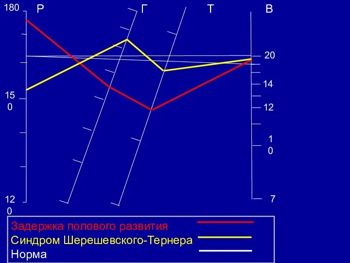 120 150 180 Р Г Т В 7 10 12 14