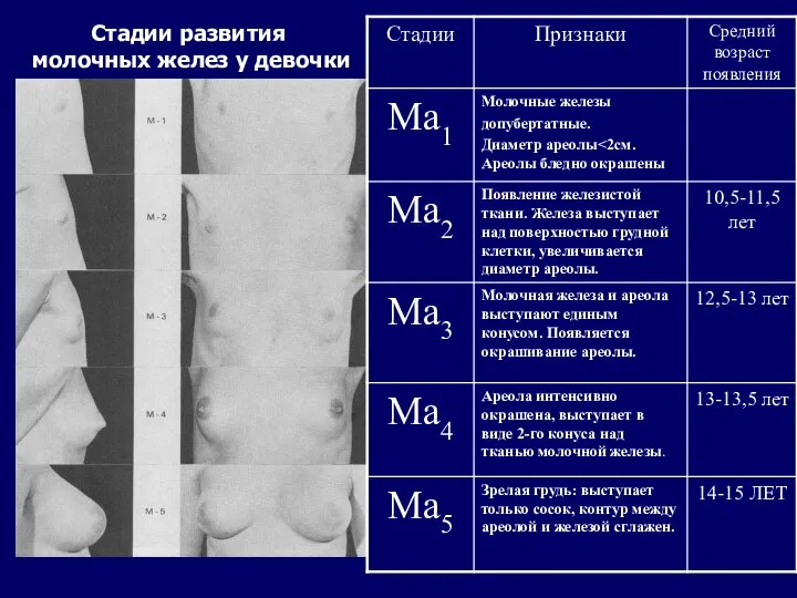 Стадии развития молочных желез у девочки