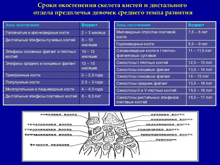 Сроки окостенения скелета кистей и дистального отдела предплечья девочек среднего темпа развития трапеция