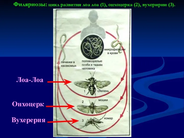 Филяриозы: цикл развития лоа лоа (1), онхоцерка (2), вухеририи (3). Лоа-Лоа Онхоцерк Вухерерия