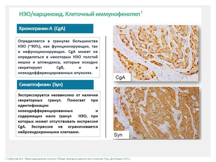 1. Горбунова В.А. Нейроэндокринные опухоли. Общие принципы диагностики и лечения. Изд. Дом Кодекс 2015 г. 1