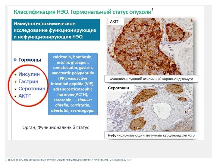 1.Горбунова В.А. Нейроэндокринные опухоли. Общие принципы диагностики и лечения. Изд. Дом Кодекс 2015 г. 1