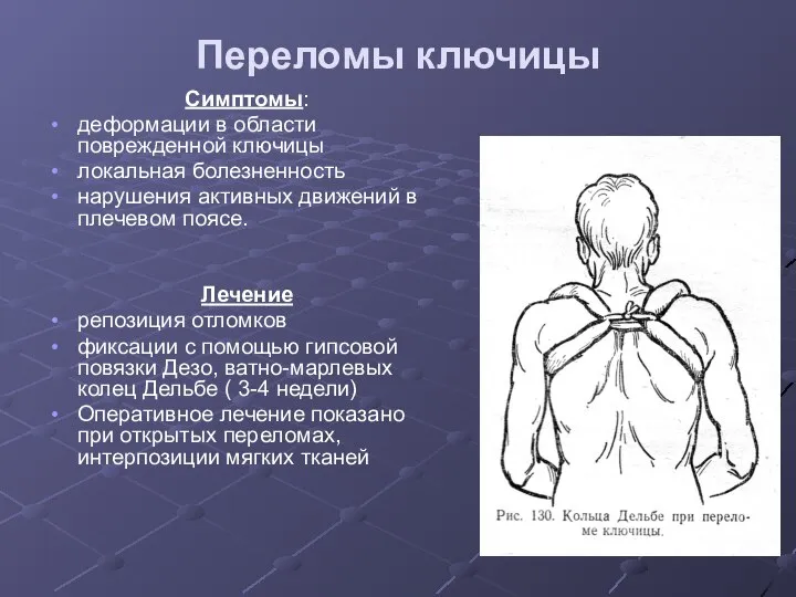 Переломы ключицы Симптомы: деформации в области поврежденной ключицы локальная болезненность нарушения