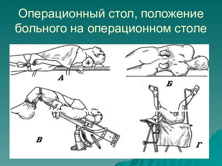 Операционный стол, положение больного на операционном столе