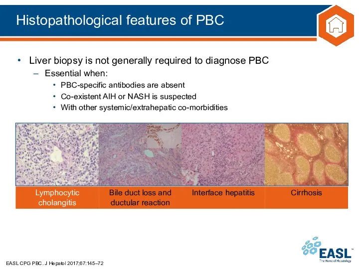 Histopathological features of PBC EASL CPG PBC. J Hepatol 2017;67:145–72 Liver