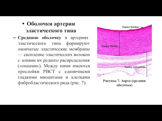 Оболочки артерии эластического типа Среднюю оболочку в артериях эластического типа формируют