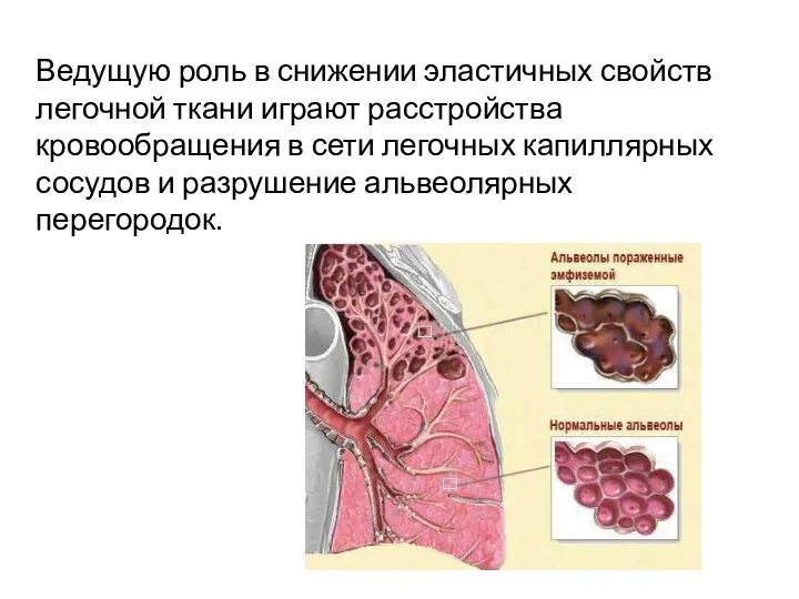 Ведущую роль в снижении эластичных свойств легочной ткани играют расстройства кровообращения