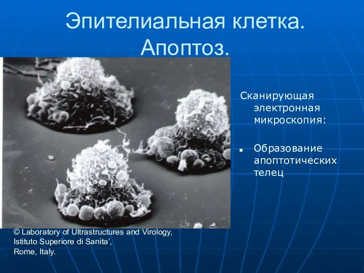 Эпителиальная клетка.Апоптоз. Сканирующая электронная микроскопия: Образование апоптотических телец © Laboratory of