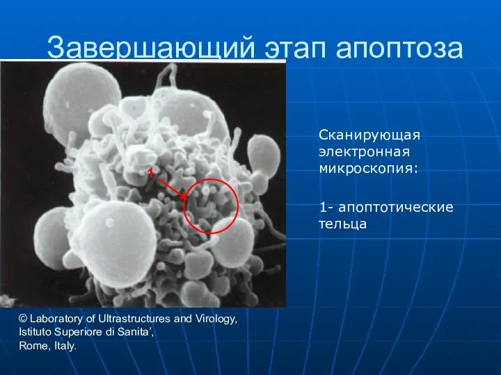 Завершающий этап апоптоза Сканирующая электронная микроскопия: 1- апоптотические тельца 1 ©