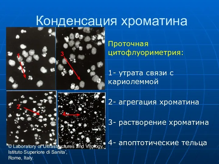 Конденсация хроматина Проточная цитофлуориметрия: 1- утрата связи с кариолеммой 2- агрегация