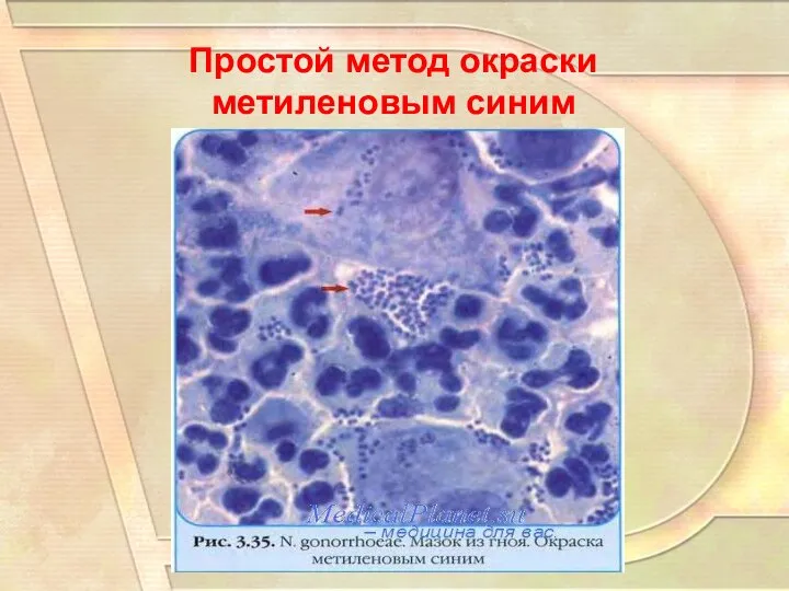 Простой метод окраски метиленовым синим