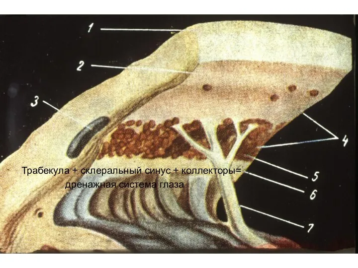 Трабекула + склеральный синус + коллекторы= дренажная система глаза