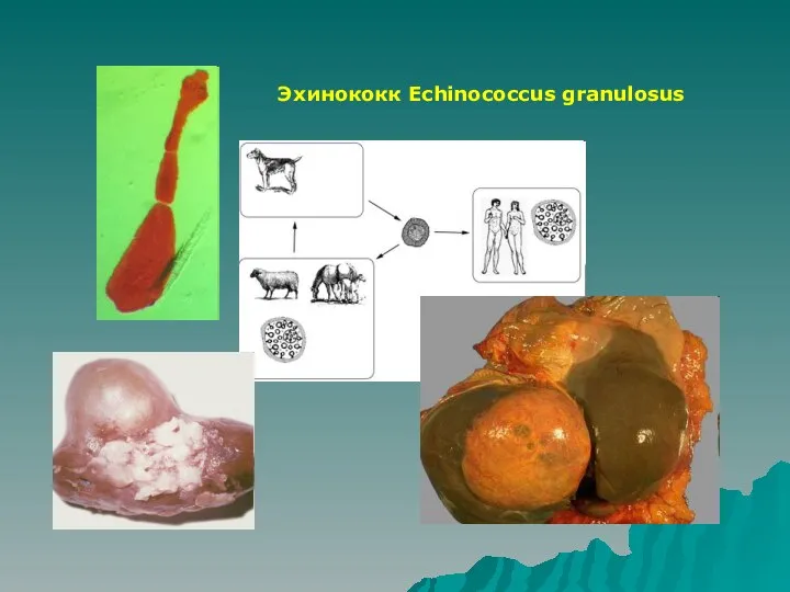 Эхинококк Echinococcus granulosus