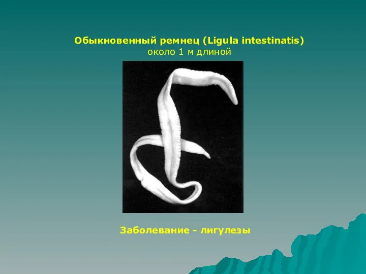 Обыкновенный ремнец (Ligula intestinatis) около 1 м длиной Заболевание - лигулезы