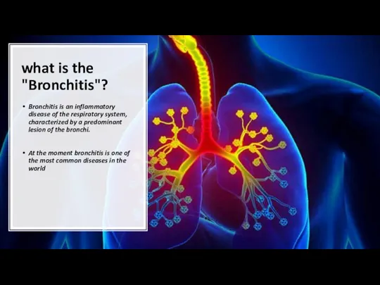 what is the "Bronchitis"? Bronchitis is an inflammatory disease of the