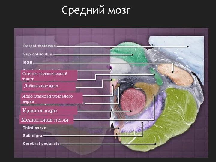 Средний мозг Спинно-таламический тракт Добавочное ядро Ядро глазодвигательного нерва Красное ядро Медиальная петля