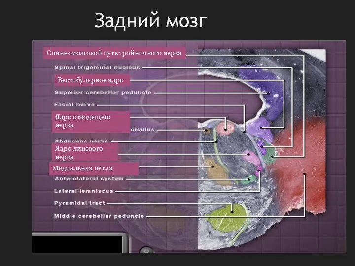 Задний мозг Спинномозговой путь тройничного нерва Вестибулярное ядро Ядро отводящего нерва Ядро лицевого нерва Медиальная петля