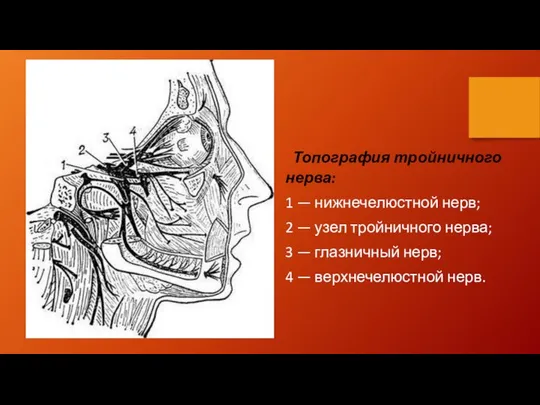 Топография тройничного нерва: 1 — нижнечелюстной нерв; 2 — узел тройничного