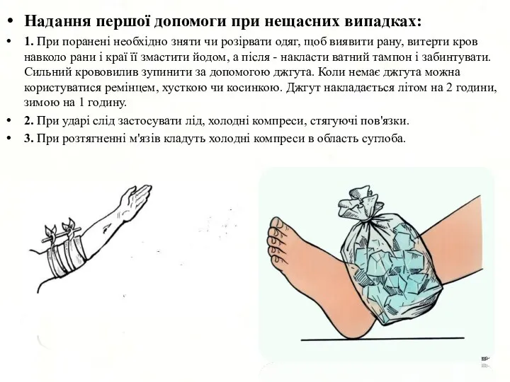 Надання першої допомоги при нещасних випадках: 1. При поранені необхідно зняти