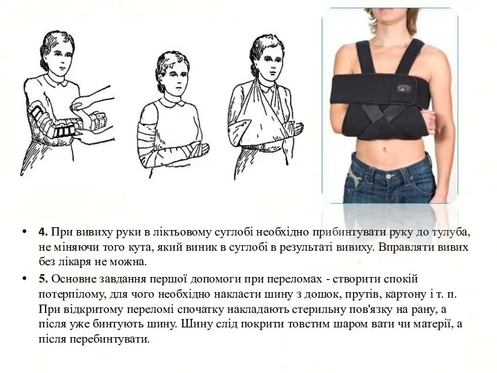 4. При вивиху руки в ліктьовому суглобі необхідно прибинтувати руку до