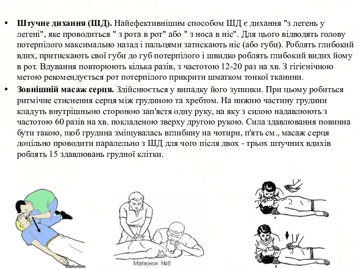 Штучне дихання (ШД). Найефективнішим способом ШД є дихання "з легень у