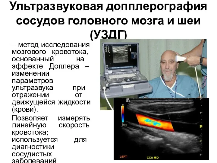 Ультразвуковая допплерография сосудов головного мозга и шеи (УЗДГ) – метод исследования