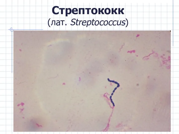 Стрептококк (лат. Streptococcus)