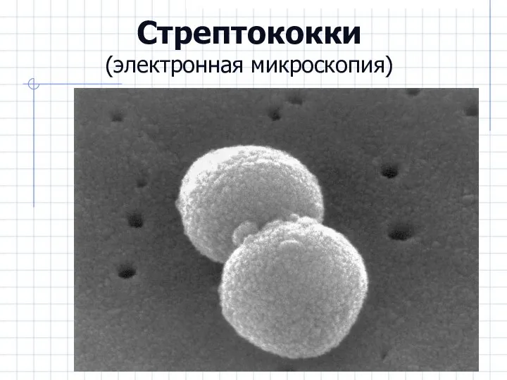 Стрептококки (электронная микроскопия)