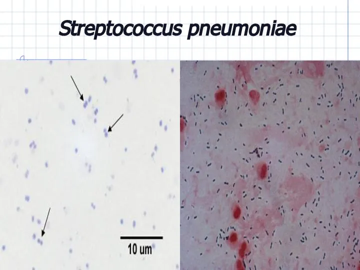 Streptococcus pneumoniae