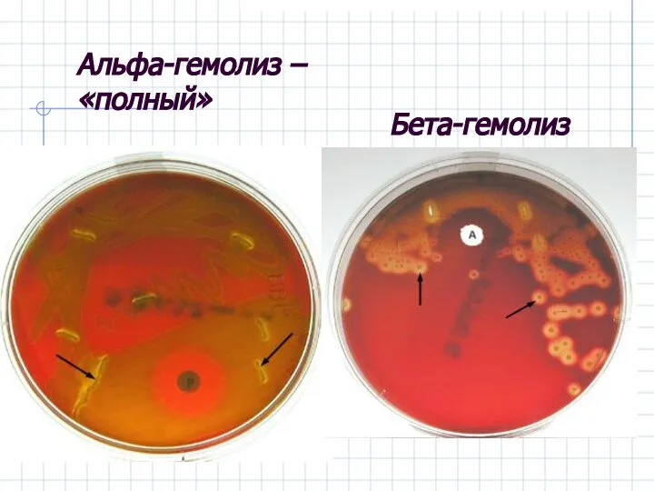 Альфа-гемолиз – «полный» Бета-гемолиз