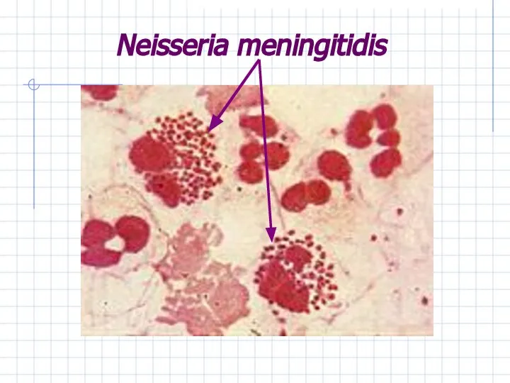 Neisseria meningitidis