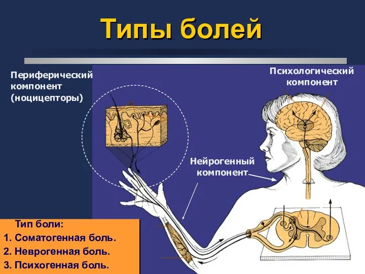 Типы болей Периферический компонент (ноцицепторы) Нейрогенный компонент Психологический компонент ДОРСАЛЬНЫЙ РОГ