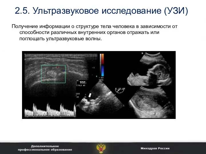 2.5. Ультразвуковое исследование (УЗИ) Получение информации о структуре тела человека в