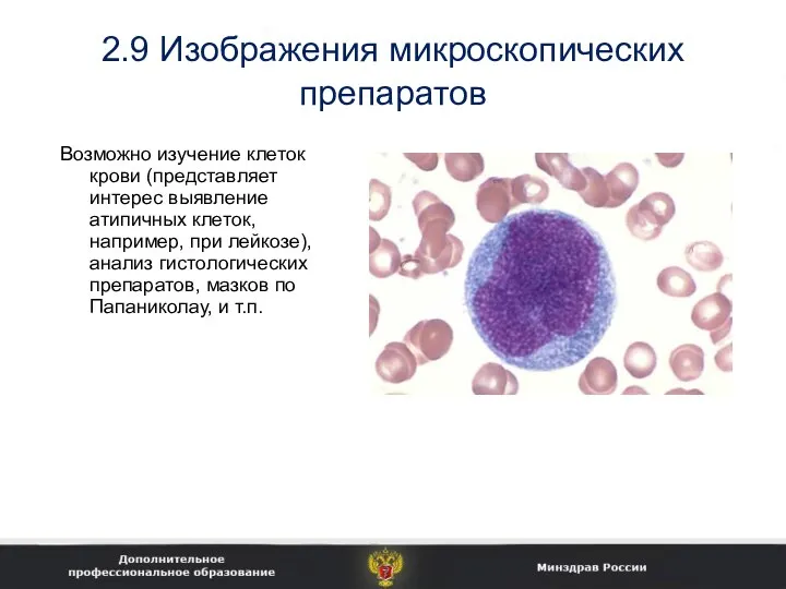 2.9 Изображения микроскопических препаратов Возможно изучение клеток крови (представляет интерес выявление