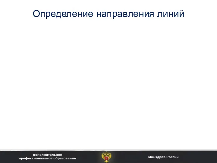 Определение направления линий