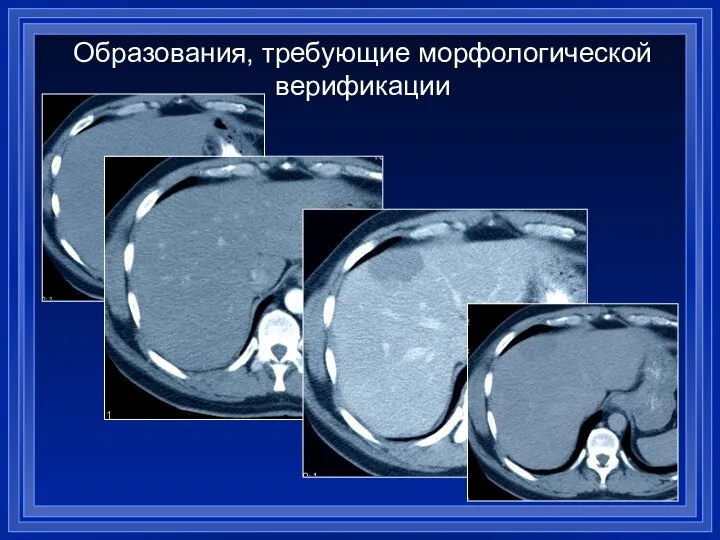 Образования, требующие морфологической верификации