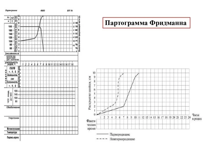 Партограмма Фридманна