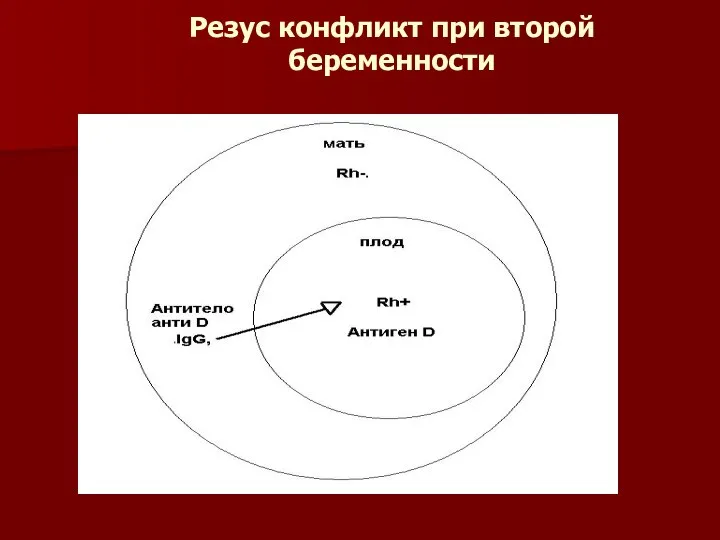 Резус конфликт при второй беременности