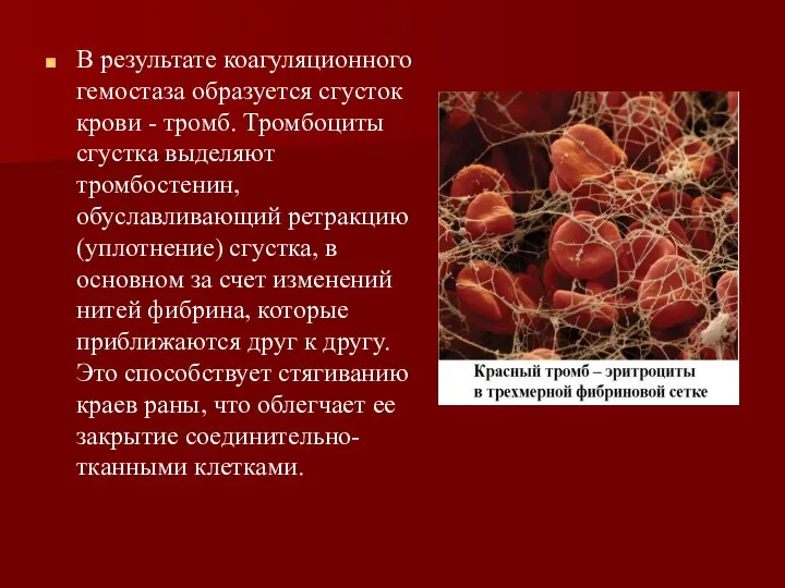 В результате коагуляционного гемостаза образуется сгусток крови - тромб. Тромбоциты сгустка