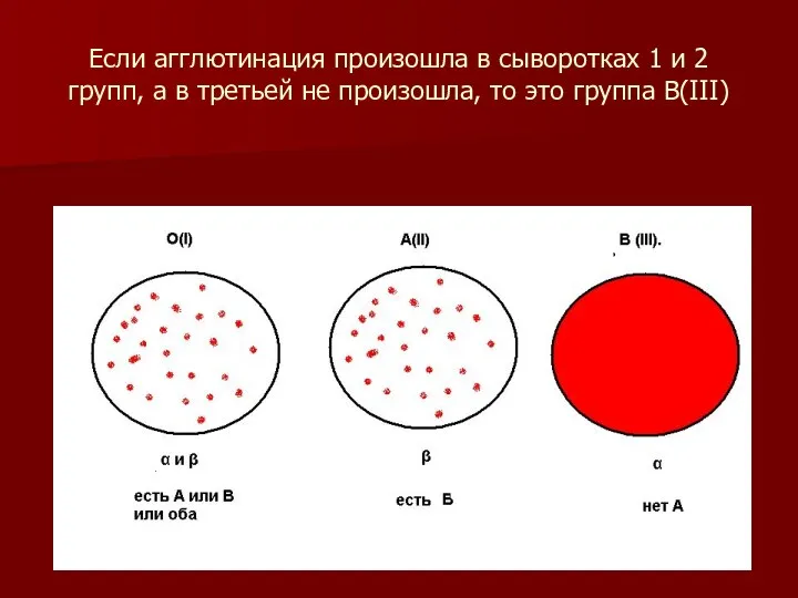 Если агглютинация произошла в сыворотках 1 и 2 групп, а в