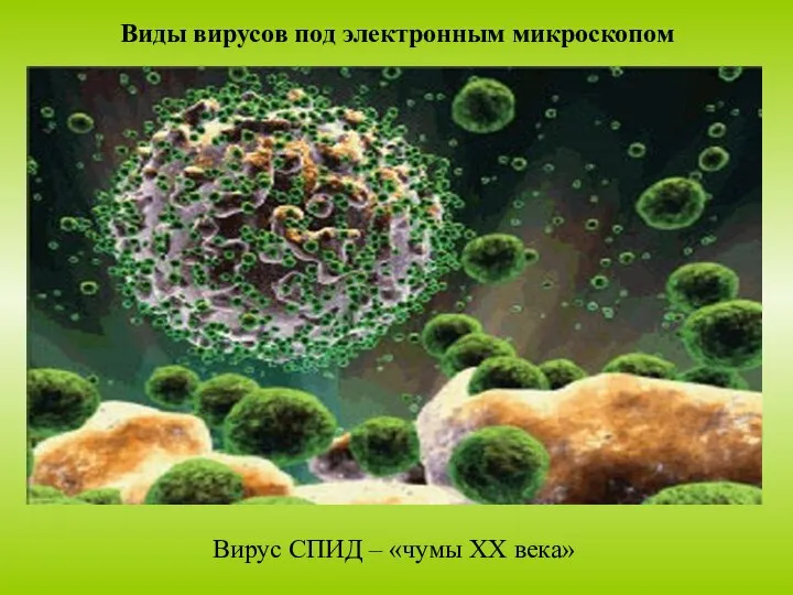 Вирус СПИД – «чумы XX века» Виды вирусов под электронным микроскопом