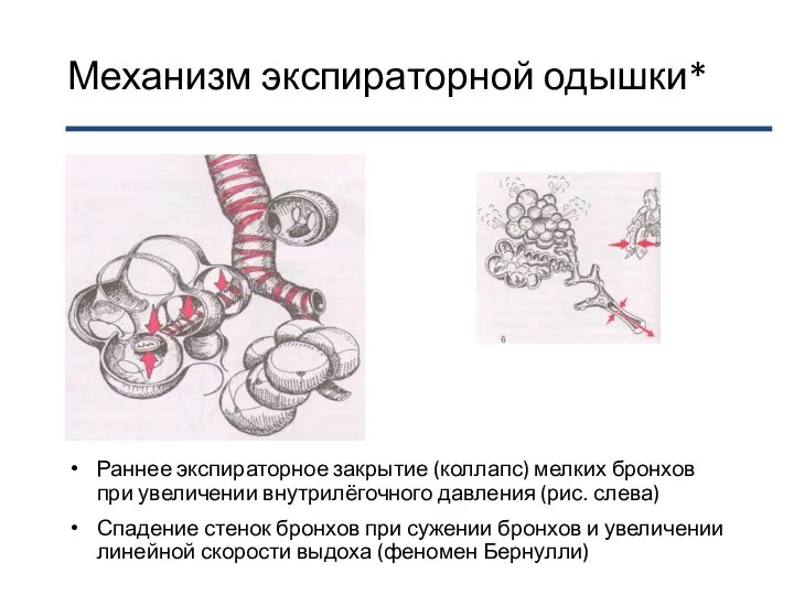 Механизм экспираторной одышки* Раннее экспираторное закрытие (коллапс) мелких бронхов при увеличении