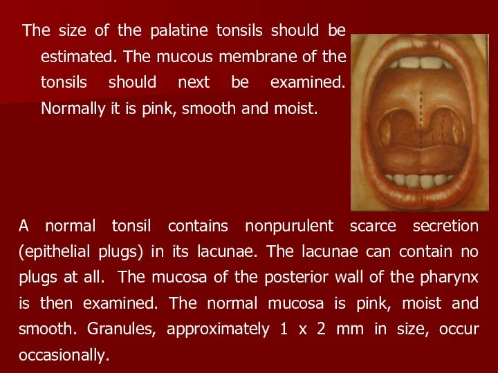 The size of the palatine tonsils should be estimated. The mucous