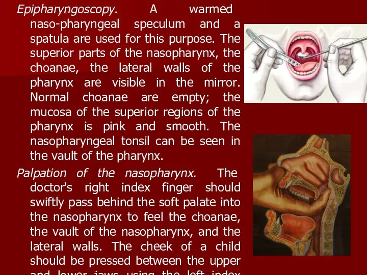 Epipharyngoscopy. A warmed naso-pharyngeal speculum and a spatula are used for