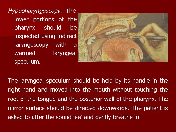 Hypopharyngoscopy. The lower portions of the pharynx should be inspected using