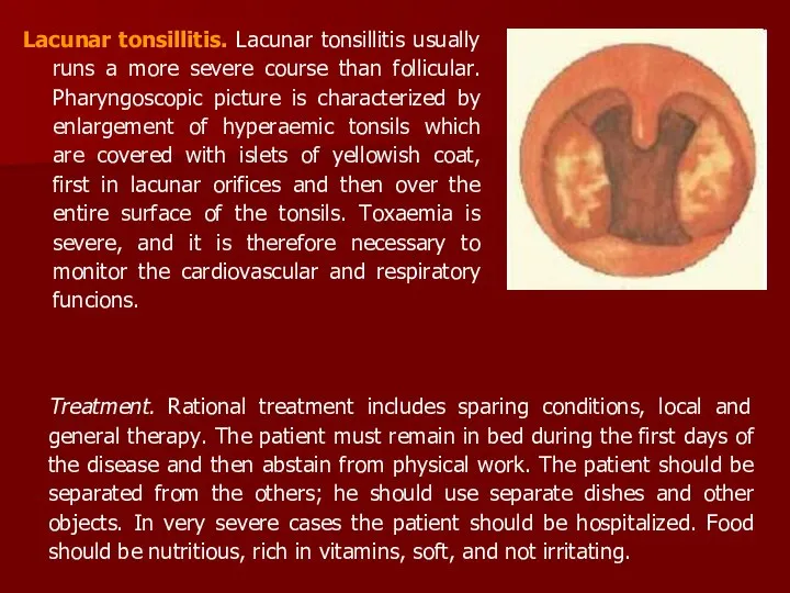 Lacunar tonsillitis. Lacunar tonsillitis usually runs a more severe course than