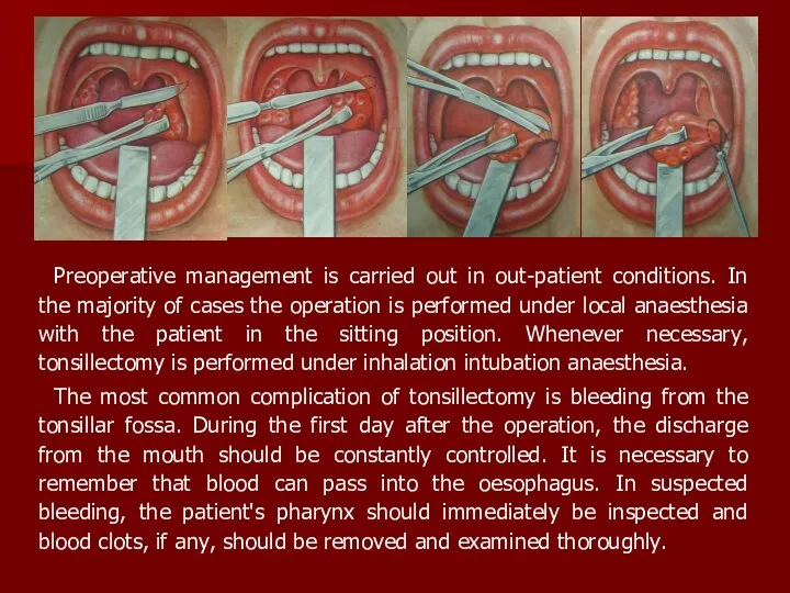 Preoperative management is carried out in out-patient conditions. In the majority